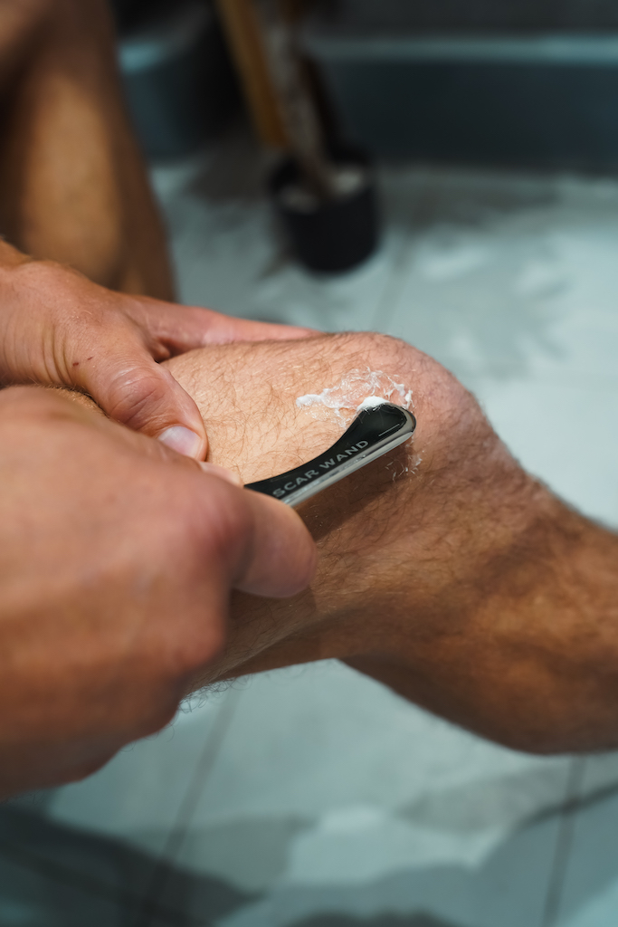 Man using The Scar Wand on his leg