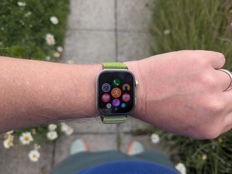 Overhead view of a man's arm with a sports watch