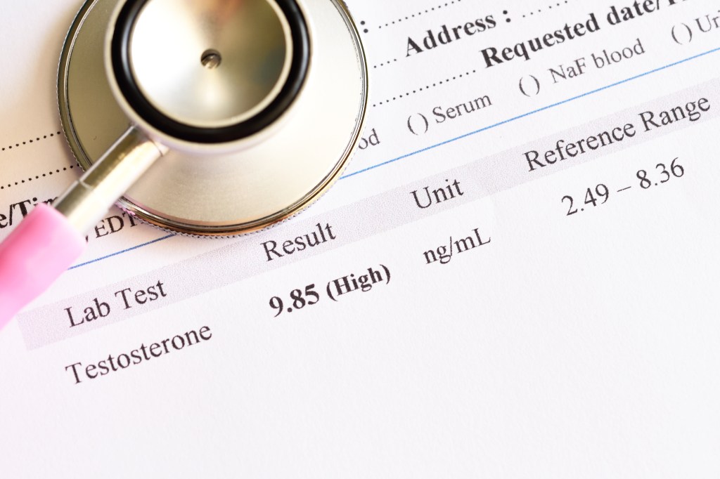 Higher testosterone can be bad for your health