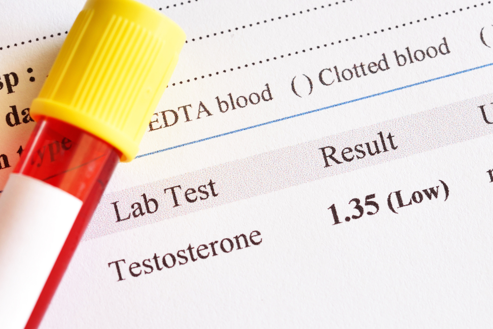 low levels of testosterone in middle age which can lead to symptoms of fatigue, low libido and brain fog